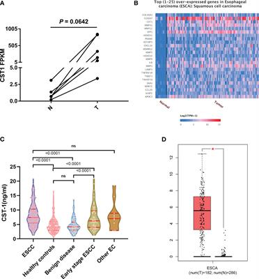 Validation of serum cystatin SN detection for diagnosis and poor prognosis of esophageal squamous cell carcinoma